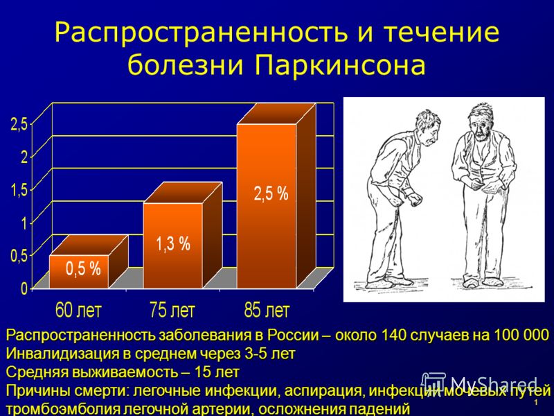 Статистика альцгеймера