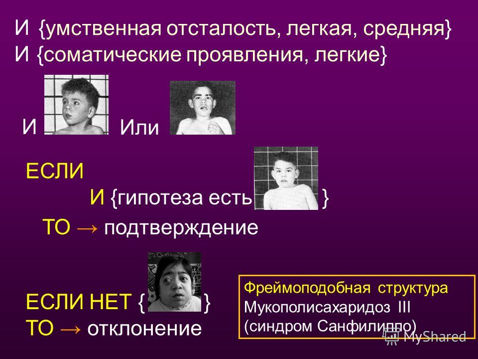 Легкая умственная отсталость. Известные люди с умственной отсталостью. Болезни Санфилиппо подтипа а.. Презентация Олесь Санфилиппо. Умственно-отсталый Филин.