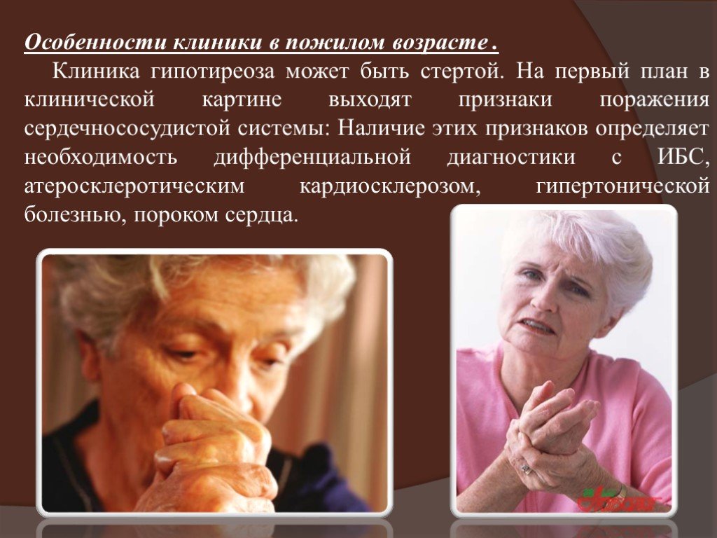 Течение заболеваний у пожилых. Гипотиреоз в пожилом возрасте. Гипотиреоз в старческом возрасте. Заболевания в пожилом возрасте. Гипотиреоз у лиц пожилого возраста.
