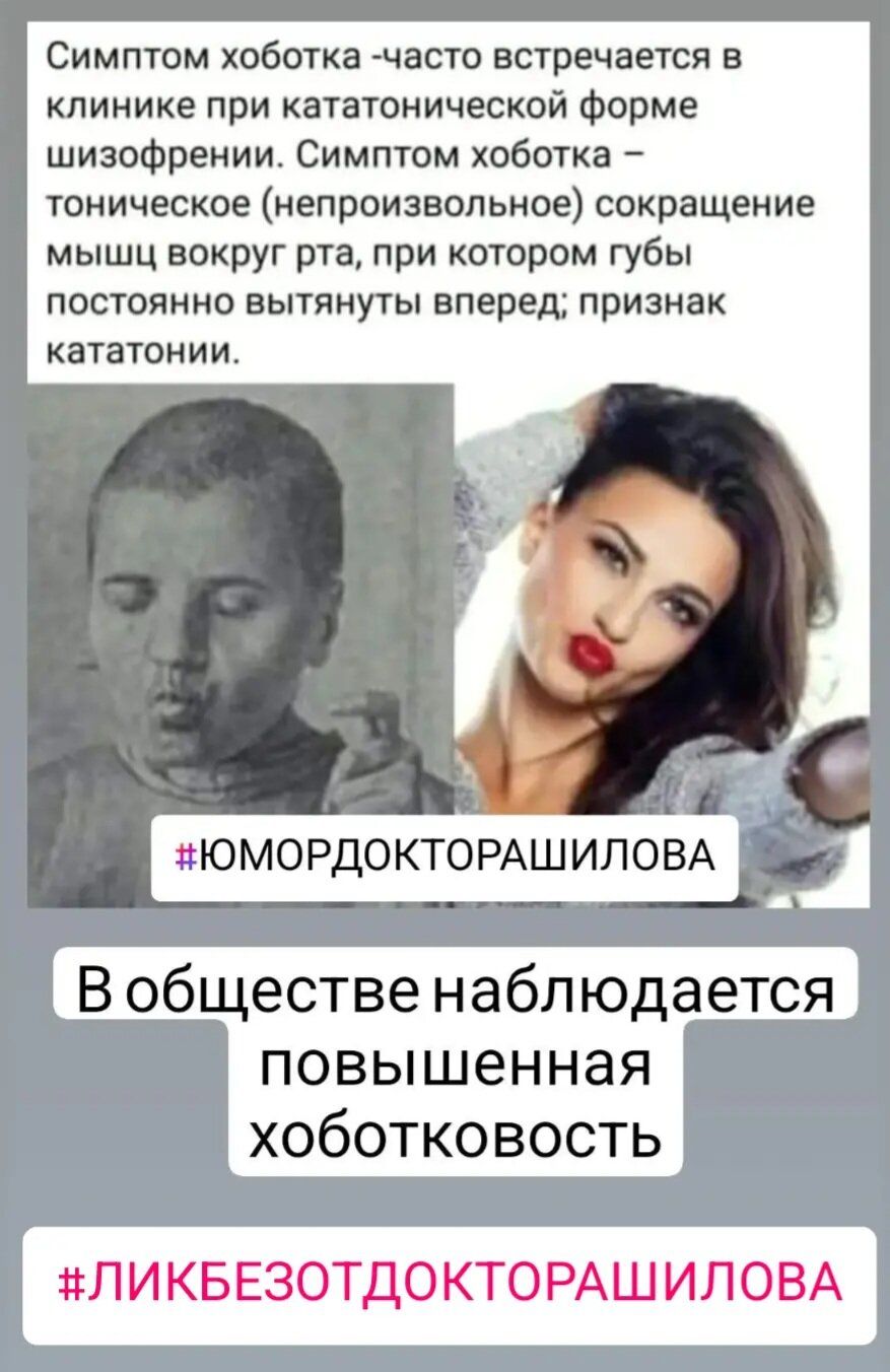 Симптом хоботка