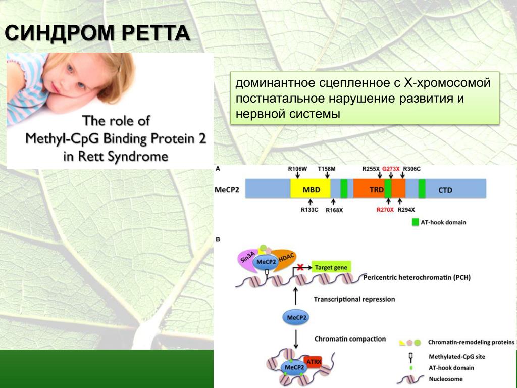 Синдром ретта презентация с картинками