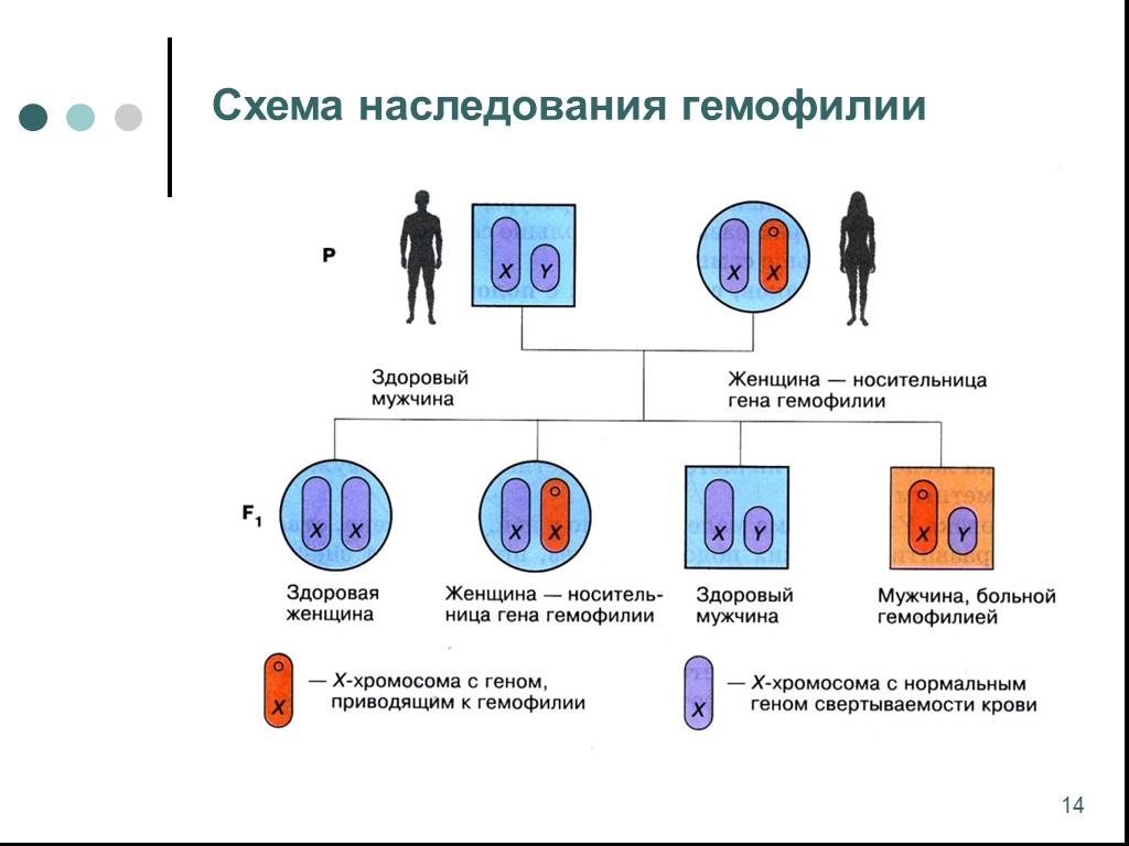 Гемофилия отец болен. Схема наследования гемофилии. Наследование признаков сцепленных с полом схема. Генетическая схема наследования гемофилии. Наследование сцепленное с полом генетическая схема.