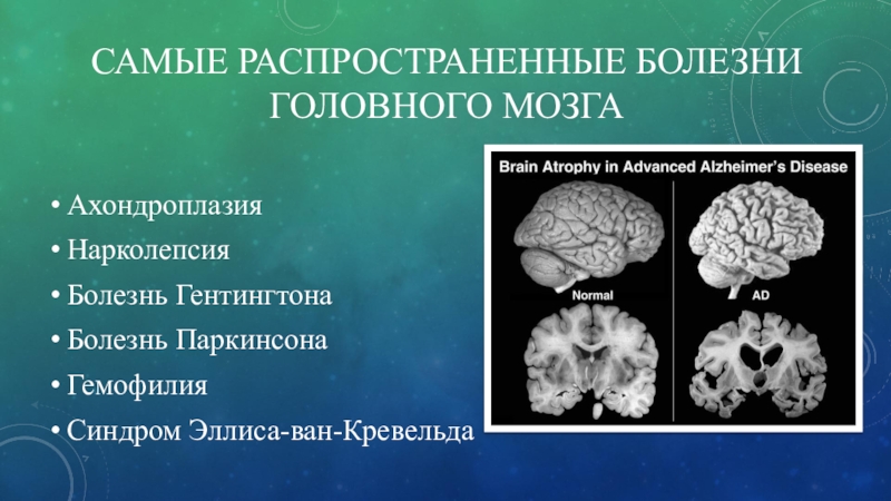 Атрофия мозга симптомы. Заболевание мозга название. Заболевания головного мозга список. Патология головного мозга.